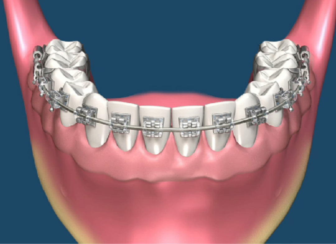 Ortodontia em Santana